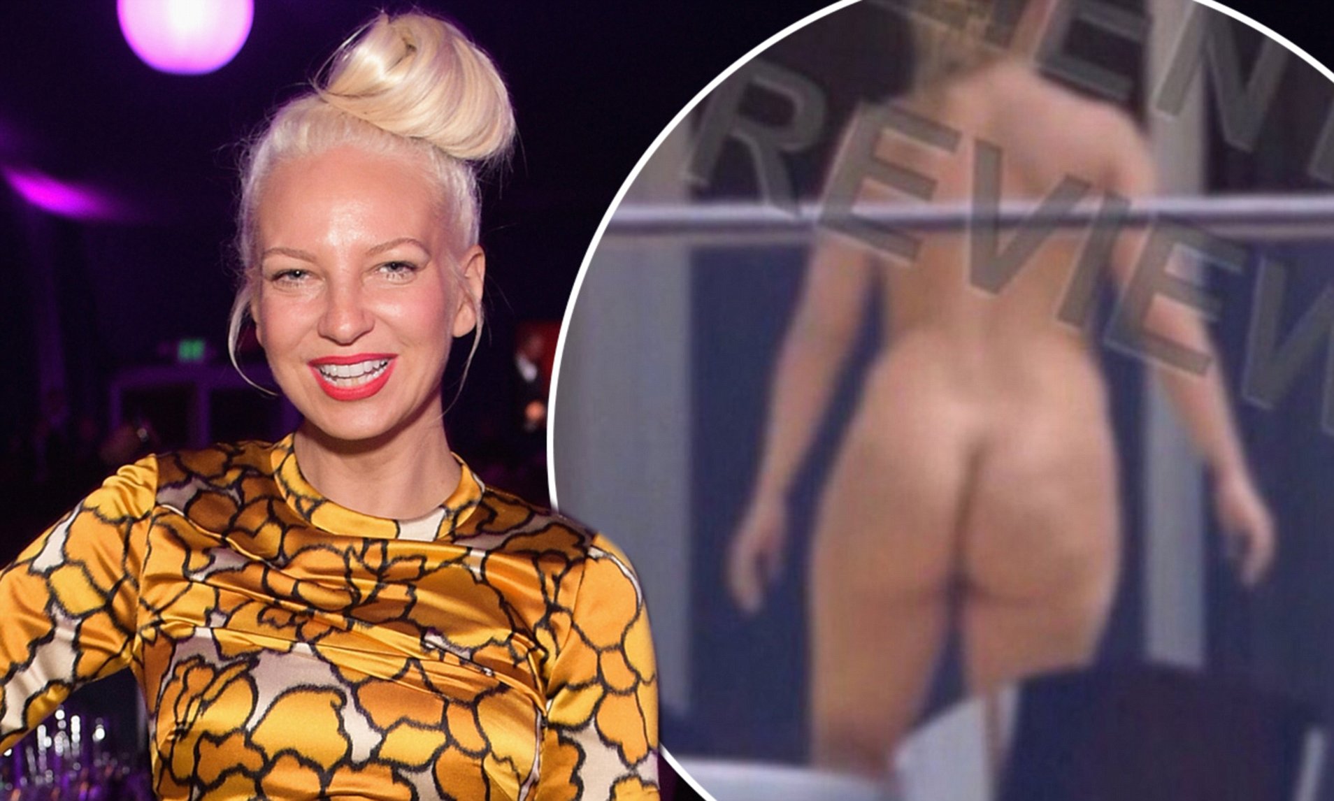 Sia Nudes Leaked photo 22